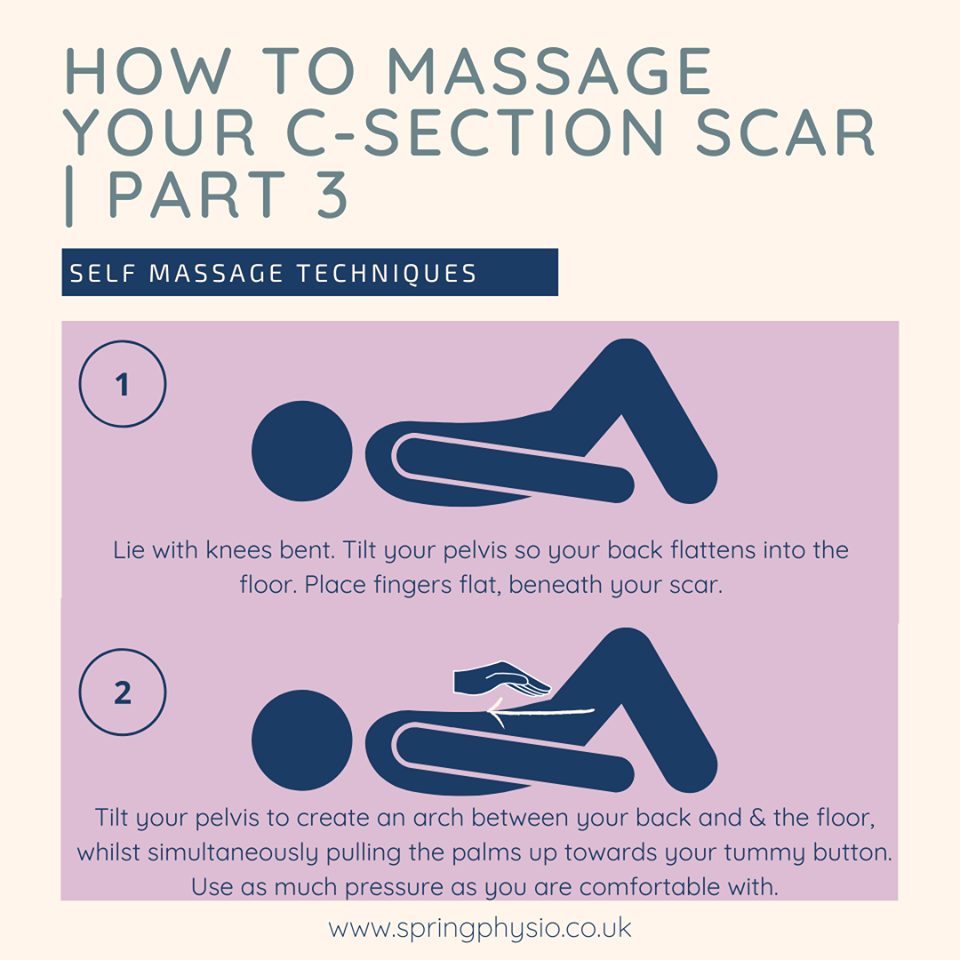 c-section recovery self massage