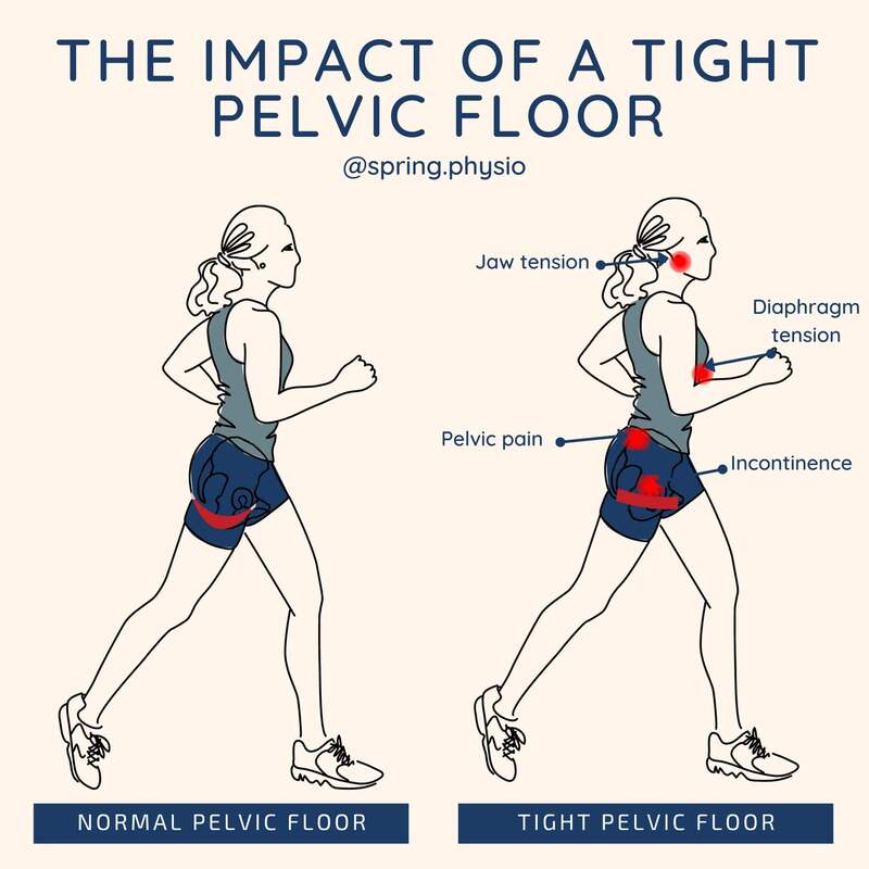 Impact of tight pelvic floor