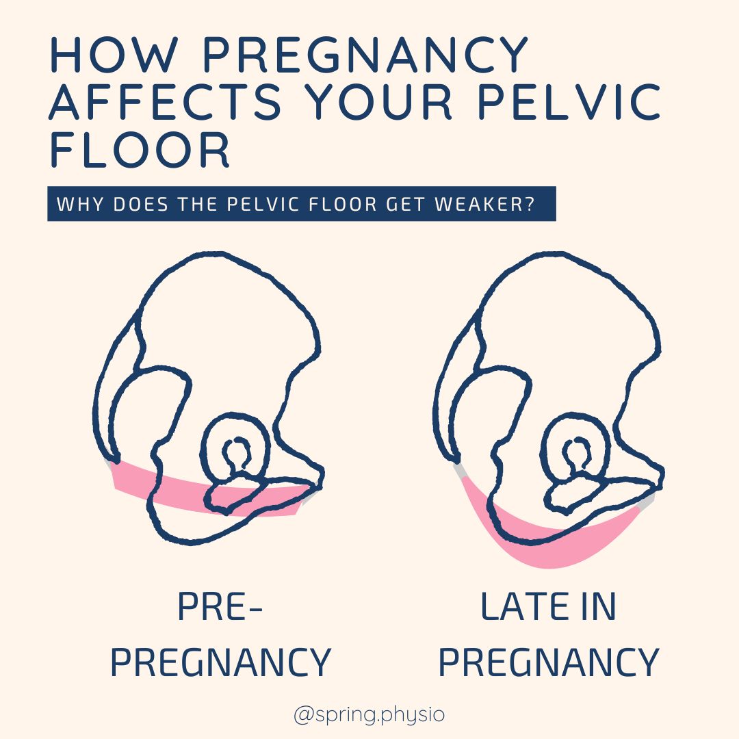 Pelvic floor in pregnancy